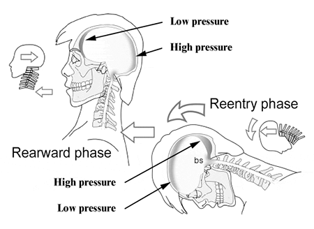 Whiplash! A Patient's Guide to Recovery.