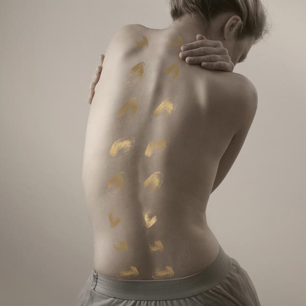 The side effects of scoliosis that no one talks about
