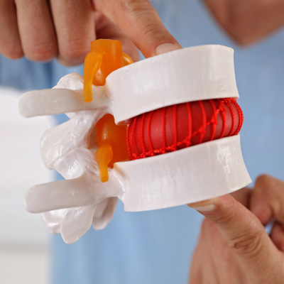 pinched nerve vs herniated disc
